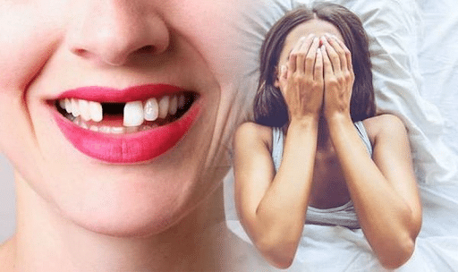 Lý do mọi người nằm mơ thấy gãy răng là gì?